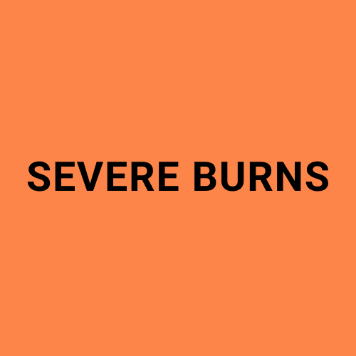 Image showing the words "Severe Burns".