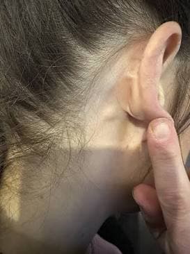Checking for Swollen Lymph Nodes Behind the Ear. Source: Blood Cancer UK Forum
